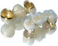 Протезирование зубов драгоценными металлами
