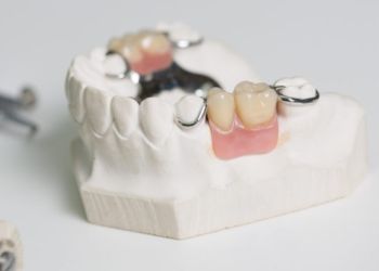 Бюгельный протез на нижнюю челюсть