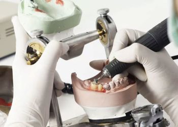 Изготовление бюгельного протеза